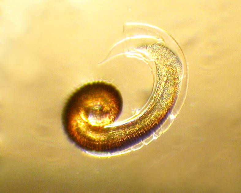 Protostrongylidae larvae from mollusks of Armenia (e)
